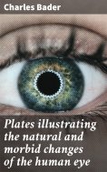 ebook: Plates illustrating the natural and morbid changes of the human eye