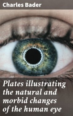 ebook: Plates illustrating the natural and morbid changes of the human eye