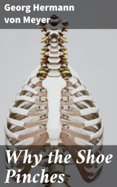 eBook: Why the Shoe Pinches