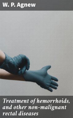 eBook: Treatment of hemorrhoids, and other non-malignant rectal diseases