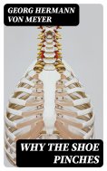 eBook: Why the Shoe Pinches