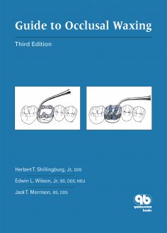 ebook: Guide to Occlusal Waxing