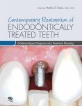 ebook: Contemporary Restoration of Endodontically Treated Teeth