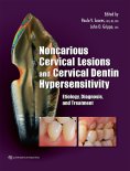 ebook: Noncarious Cervical Lesions and Cervical Dentin Hypersensitivity