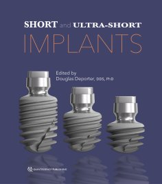ebook: Short and Ultra-Short Implants