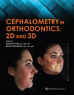 ebook: Cephalometry in Orthodontics