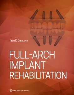ebook: Full-Arch Implant Rehabilitation