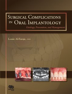 ebook: Surgical Complications in Oral Implantology