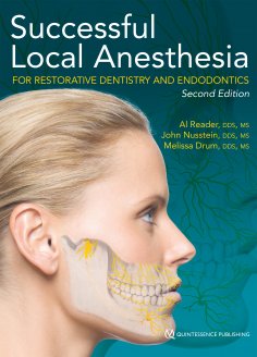 ebook: Successful Local Anesthesia for Restorative Dentistry and Endodontics