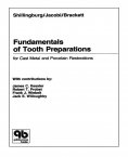 ebook: Fundamentals of Tooth Preparations for Cast Metal and Porcelain Restorations