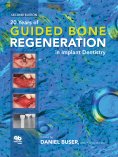 eBook: 20 Years of Guided Bone Regeneration in Implant Dentistry