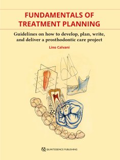 ebook: Fundamentals of Treatment Planning
