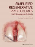 ebook: Simplified Regenerative Procedures for Intraosseous Defects