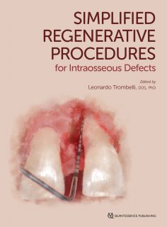 ebook: Simplified Regenerative Procedures for Intraosseous Defects