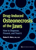ebook: Drug-Induced Osteonecrosis of the Jaws