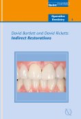 ebook: Indirect Restorations