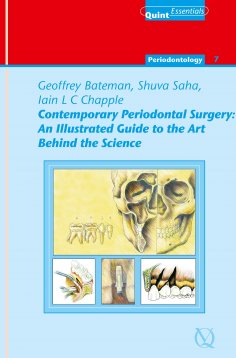 ebook: Contemporary Periodontal Surgery