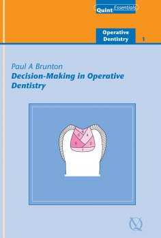 ebook: Decision-Making in Operative Dentistry