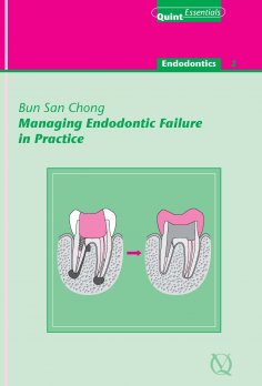 ebook: Managing Endodontic Failure in Practice