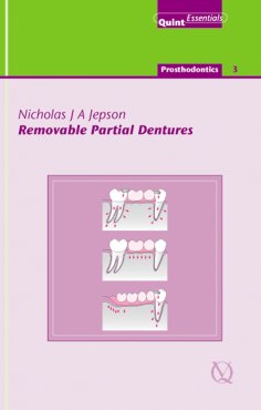 ebook: Removable Partial Dentures