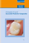 ebook: Successful Posterior Composites