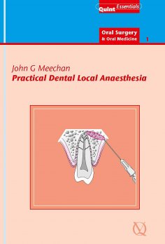 ebook: Practical Dental Local Anaesthesia