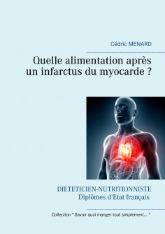 eBook: Quelle alimentation après un infarctus du myocarde ?