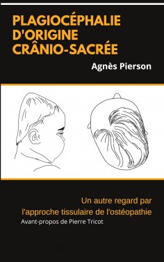 eBook: plagiocéphalie d'origine crânio-sacrée