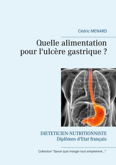 eBook: Quelle alimentation pour l'ulcère gastrique ?