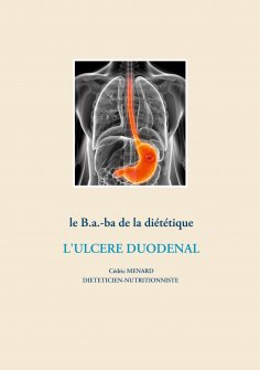ebook: Le b.a.-ba de la diététique pour l'ulcère duodénal