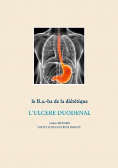 eBook: Le b.a.-ba de la diététique pour l'ulcère duodénal