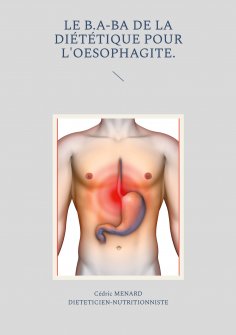 eBook: Le b.a-ba de la diététique pour l'oesophagite.