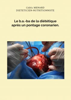 eBook: Le b.a.-ba de la diététique après un pontage coronarien.