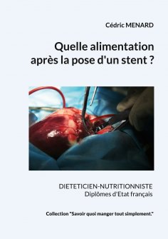 eBook: Quelle alimentation après la pose d'un stent ?