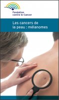 ebook: Mélanome et cancer de la peau