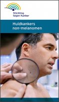 ebook: Huidkanker non-melanomen
