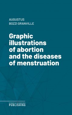eBook: Graphic illustrations of abortion and the diseases of menstruation