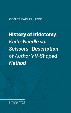 eBook: History of Iridotomy