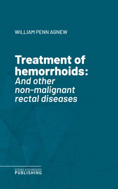 eBook: Treatment of hemorrhoids