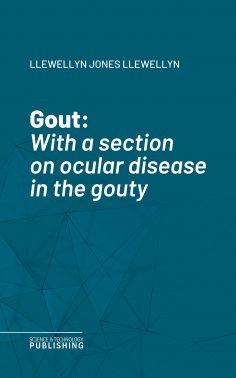 eBook: Gout