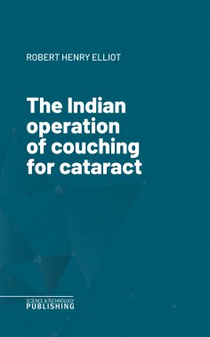 eBook: The Indian operation of couching for cataract