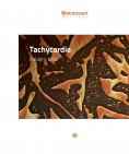 eBook: Tachycardie