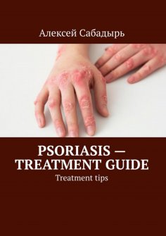 eBook: Psoriasis — treatment guide