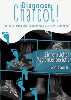 eBook: Diagnose Charcot!