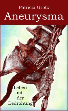 eBook: Aneurysma