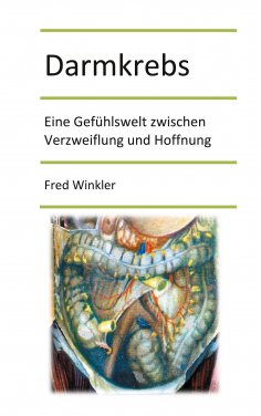 eBook: Darmkrebs