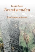 ebook: Brandwunden