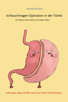 eBook: Schlauchmagen Operation in der Türkei