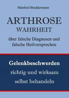 ebook: Arthrose