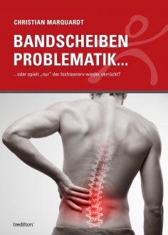 eBook: Bandscheiben Problematik